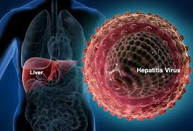 Hepatits A – Photo by webmd.com (Courtesy of Google)